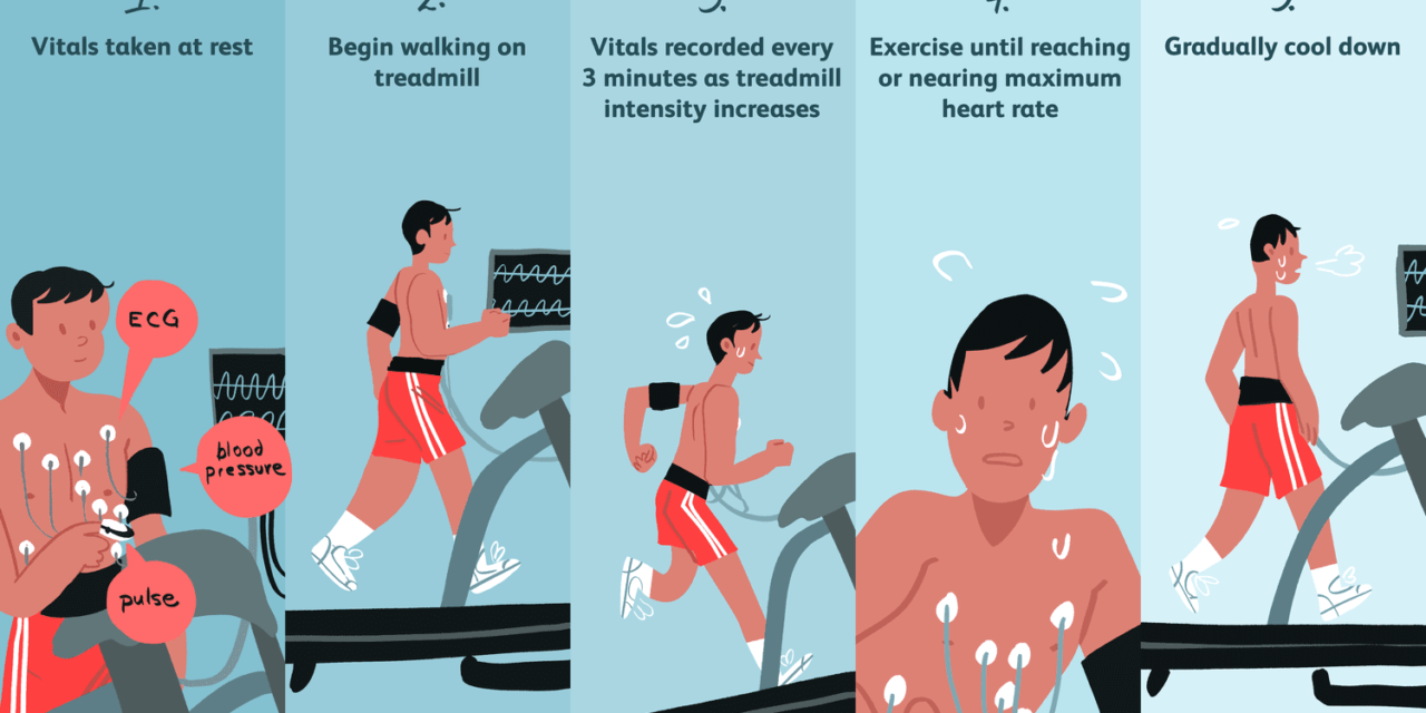 How To Pass A Treadmill Stress Test